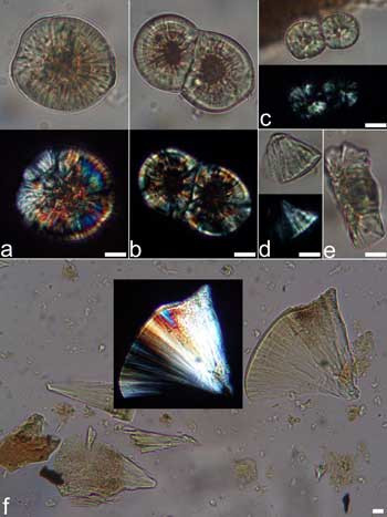 Maize starch granules under the electron microscope
